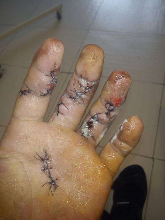 post-9600-0-50126400-1393871638_thumb.jp